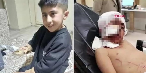 Erzurum’da 10 Yaşındaki Çocuğa Sokak Köpekleri Saldırdı