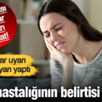 aman-dikkat-dis-agrisi-ms-multipl-sklerozun-erken-belirtisi-olabilir-ahvOtTvA.jpg