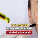 gunes-lekelerini-affetmeyen-ibn-i-sina-recetesi-her-gun-20-dakika-uygulayan-farki-goruyor-VmwUDFnw.jpg