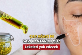 gunes-lekelerini-affetmeyen-ibn-i-sina-recetesi-her-gun-20-dakika-uygulayan-farki-goruyor-VmwUDFnw.jpg