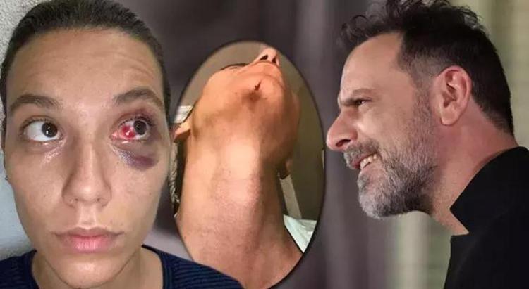 2 yıl 3 ay hapis cezası alan Ozan Güven, karar onanırsa cezaevine girecek!  - Magazin Haberleri