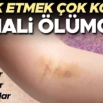 vucudunuzu-kontrol-etmek-hayat-kurtarabilir-bu-belirtiler-kanserin-habercisi-olabilir-JOYV3b14.jpg