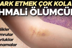 vucudunuzu-kontrol-etmek-hayat-kurtarabilir-bu-belirtiler-kanserin-habercisi-olabilir-JOYV3b14.jpg