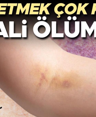 vucudunuzu-kontrol-etmek-hayat-kurtarabilir-bu-belirtiler-kanserin-habercisi-olabilir-JOYV3b14.jpg