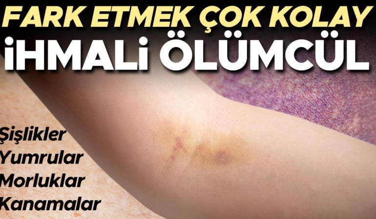 vucudunuzu-kontrol-etmek-hayat-kurtarabilir-bu-belirtiler-kanserin-habercisi-olabilir-JOYV3b14.jpg